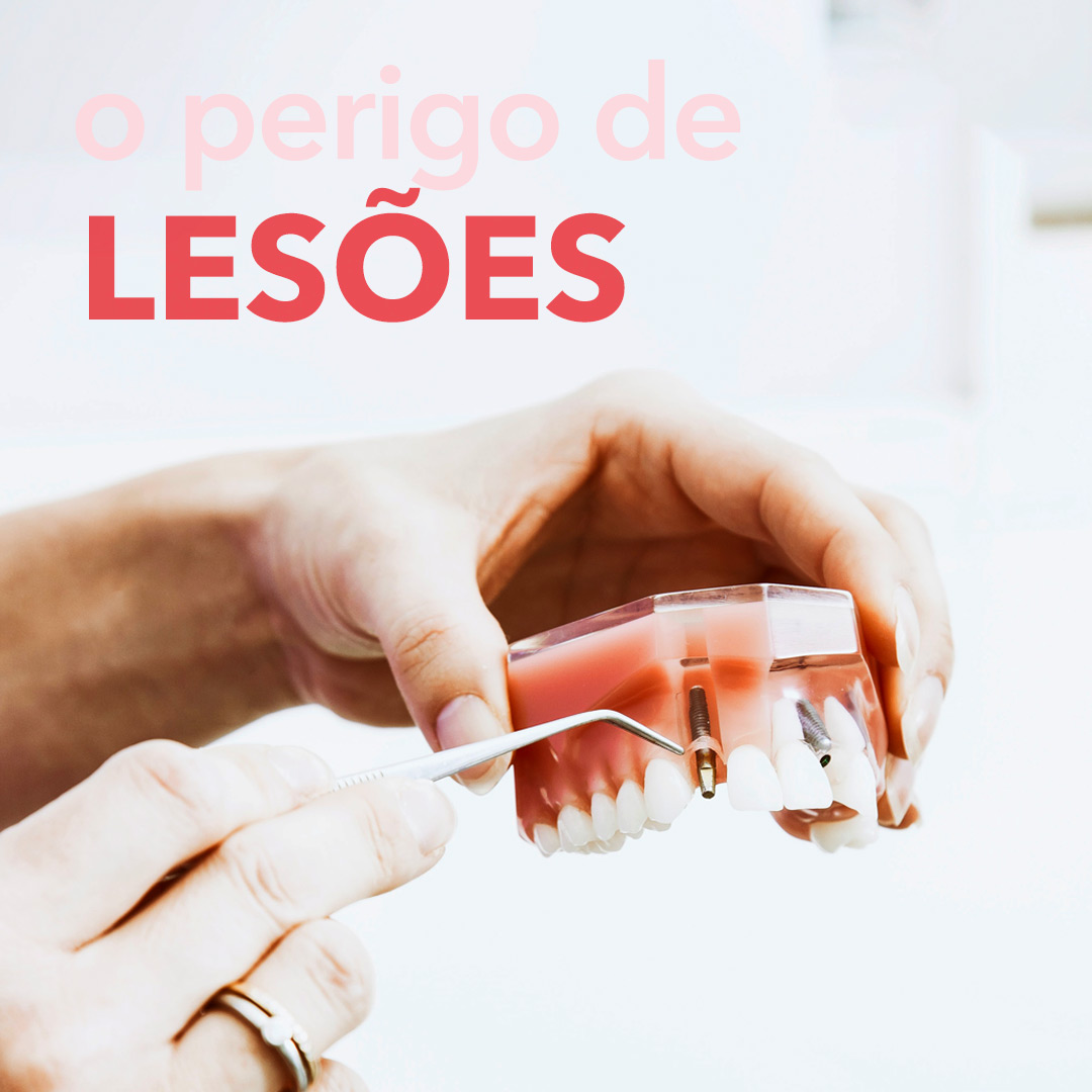 Read more about the article Uso de prótese móvel (dentadura) ou prótese parcial, e o perigo de lesão cancerígena.