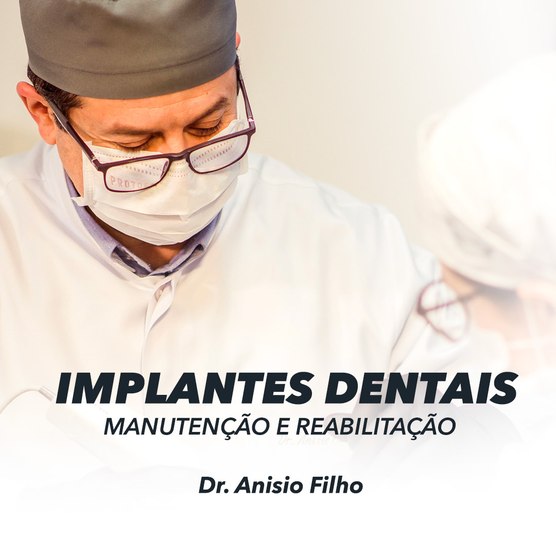 Read more about the article Reabilitação com Implantes.