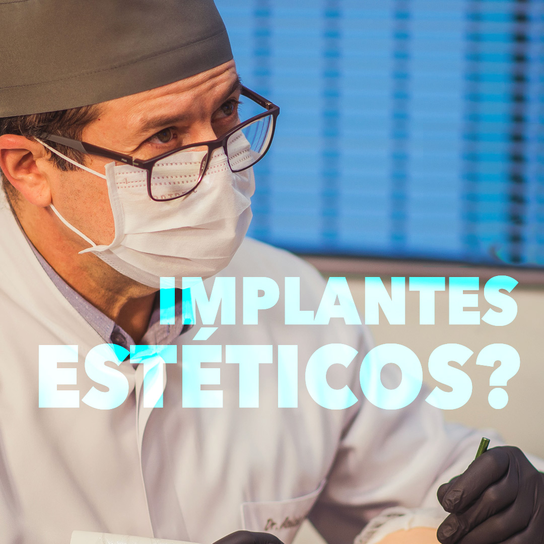 Read more about the article Implantes são dentes estéticos?