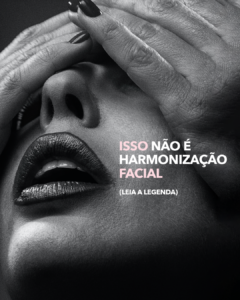 Read more about the article A verdadeira Harmonização Facial é discreta e certeira.