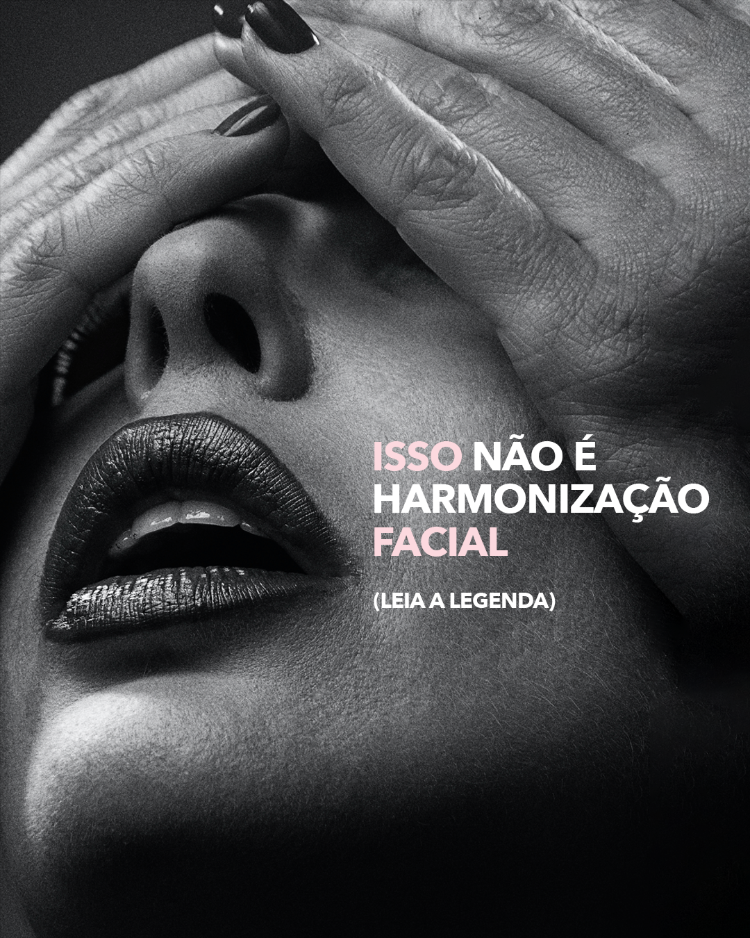 You are currently viewing A verdadeira Harmonização Facial é discreta e certeira.