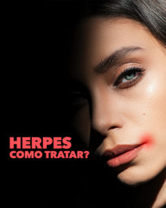 Read more about the article Herpes, como tratar?