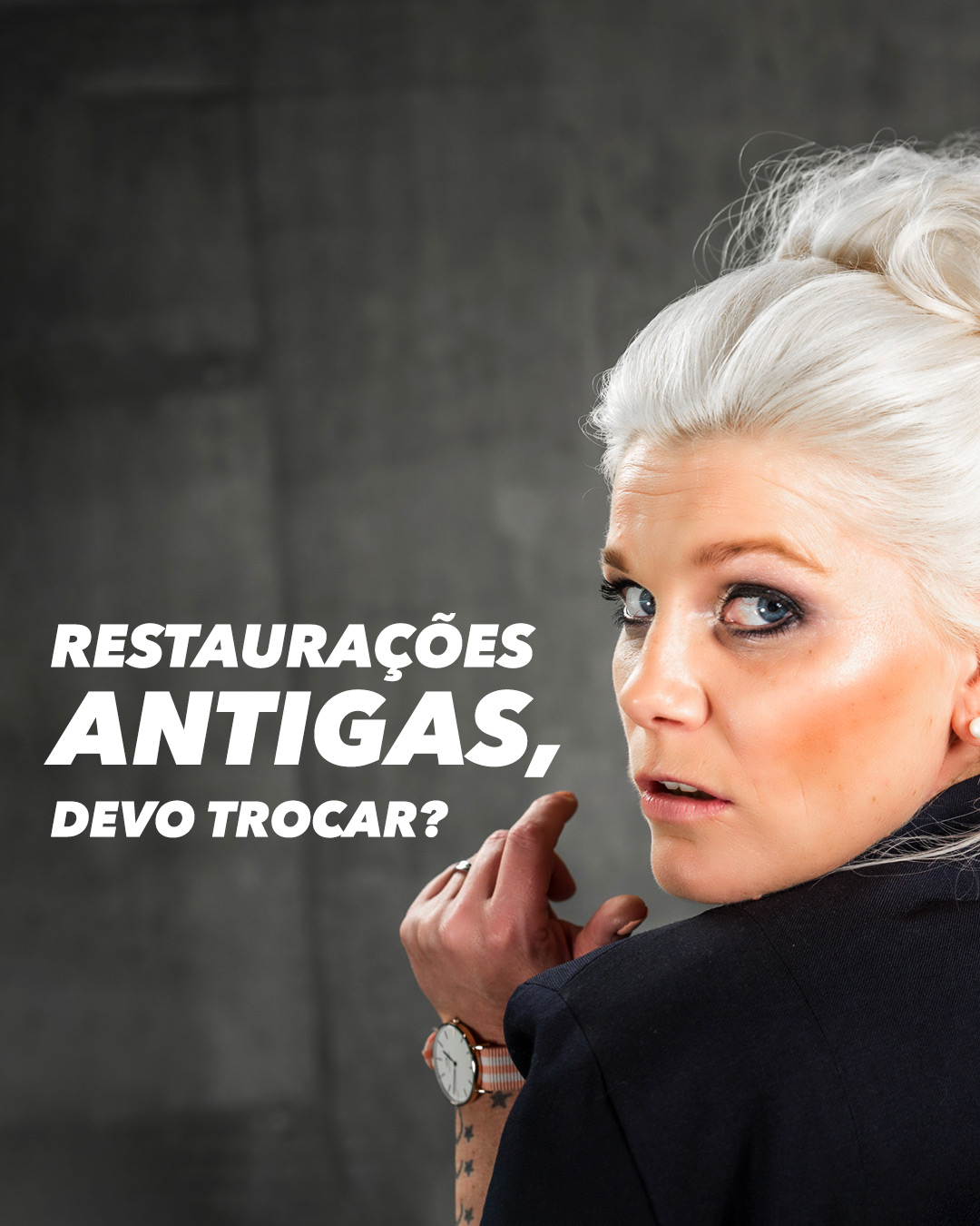 You are currently viewing Restaurações antigas, devo trocar?